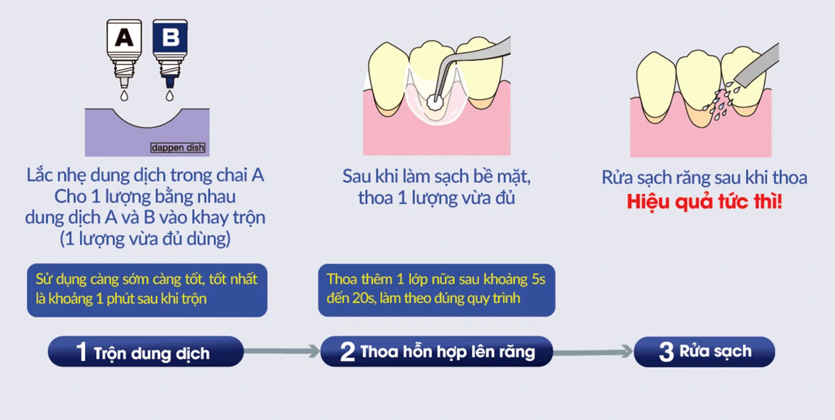 Chất chống ê buốt răng Nanoseal Nishika Nhật Bản