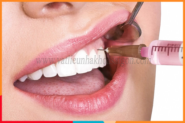 Tầm quan trọng của thuốc tê nha khoa