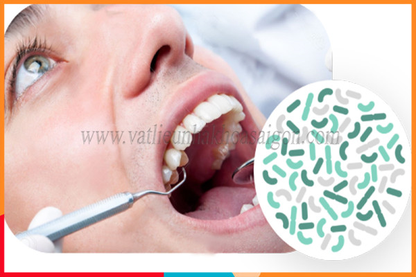 Điều chỉnh hệ vi sinh khoang miệng bằng vật liệu nha khoa hiện đại